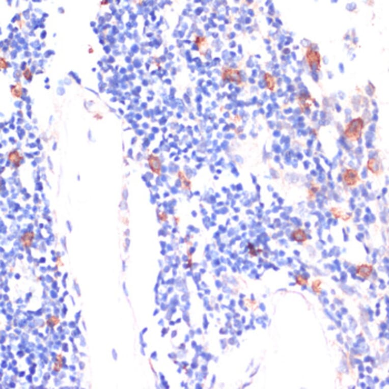 Immunohistochemistry - Anti-Wnt5b Antibody (A12230) - Antibodies.com