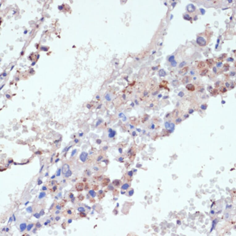 Immunohistochemistry - Anti-Wnt5b Antibody (A12230) - Antibodies.com