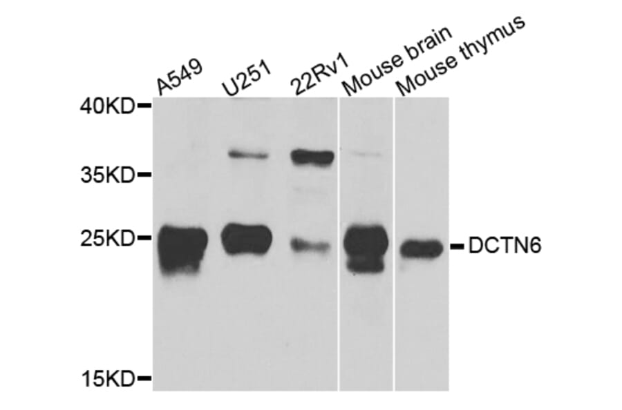Western Blot - Anti-DCTN6 Antibody (A8316) - Antibodies.com