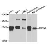 Western Blot - Anti-DCTN6 Antibody (A8316) - Antibodies.com