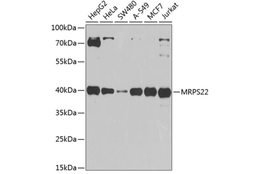 Western Blot - Anti-MRPS22 Antibody (A12232) - Antibodies.com