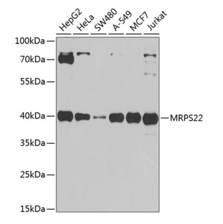 Western Blot - Anti-MRPS22 Antibody (A12232) - Antibodies.com