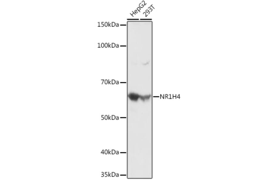 Western Blot - Anti-Bile Acid Receptor NR1H4 Antibody (A12233) - Antibodies.com