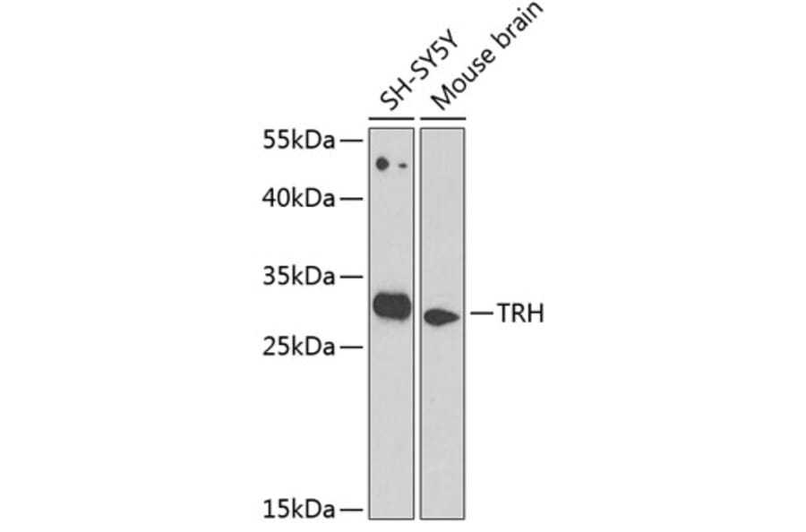 Western Blot - Anti-Thyrotropin Releasing Hormone (TRH) Antibody (A12234) - Antibodies.com