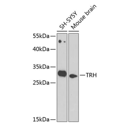 Western Blot - Anti-Thyrotropin Releasing Hormone (TRH) Antibody (A12234) - Antibodies.com