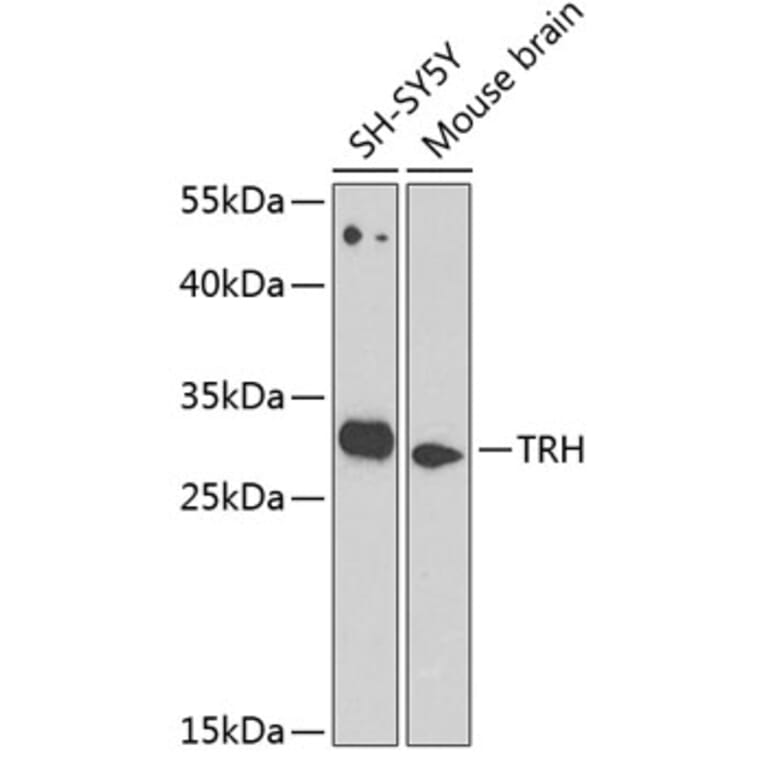 Western Blot - Anti-Thyrotropin Releasing Hormone (TRH) Antibody (A12234) - Antibodies.com