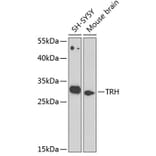 Western Blot - Anti-Thyrotropin Releasing Hormone (TRH) Antibody (A12234) - Antibodies.com