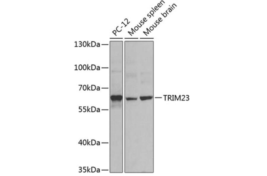 Western Blot - Anti-TRIM23/ARD1 Antibody (A12235) - Antibodies.com