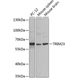 Western Blot - Anti-TRIM23/ARD1 Antibody (A12235) - Antibodies.com