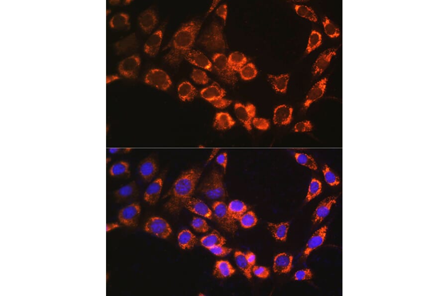 Immunofluorescence - Anti-TRIM23/ARD1 Antibody (A12235) - Antibodies.com