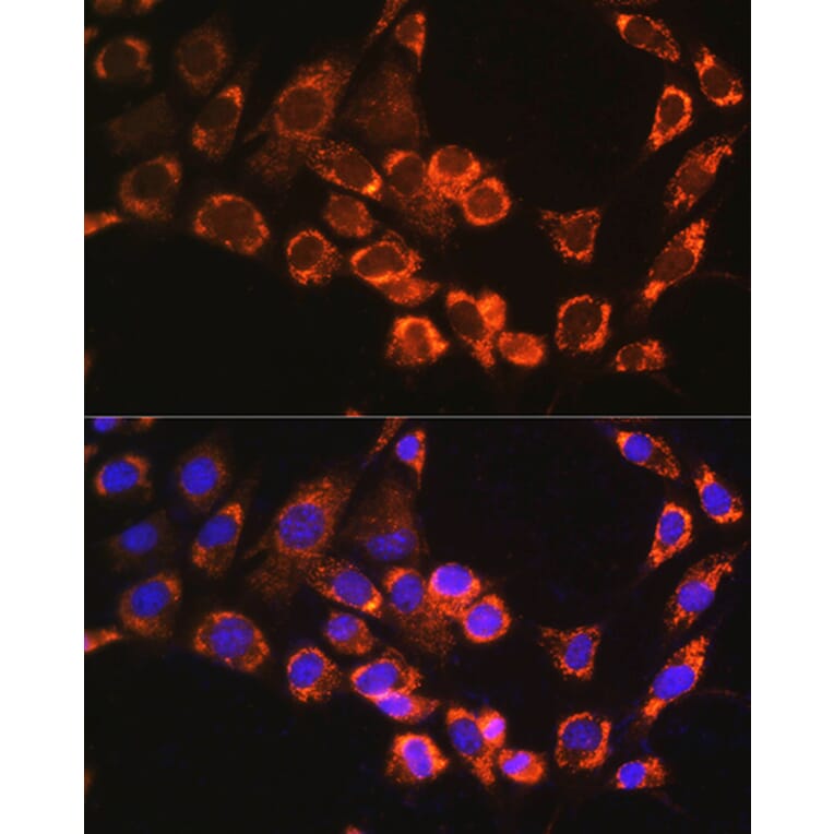 Immunofluorescence - Anti-TRIM23/ARD1 Antibody (A12235) - Antibodies.com