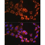 Immunofluorescence - Anti-TRIM23/ARD1 Antibody (A12235) - Antibodies.com