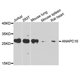 Western Blot - Anti-ANAPC10 Antibody (A8330) - Antibodies.com