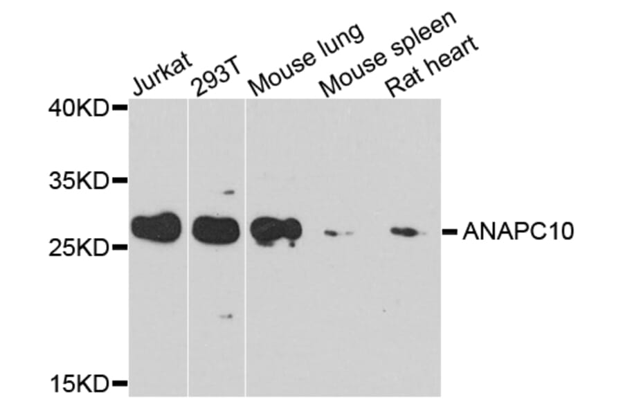 Western Blot - Anti-ANAPC10 Antibody (A8330) - Antibodies.com