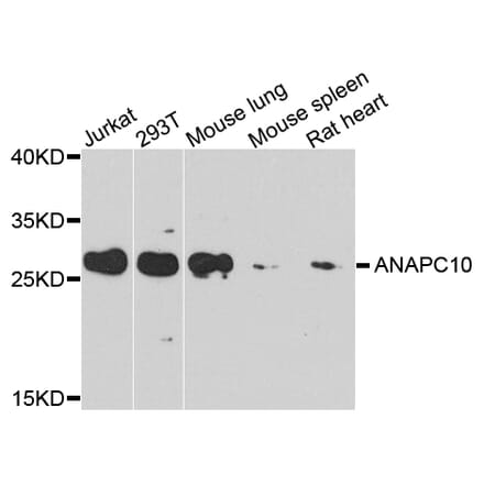 Western Blot - Anti-ANAPC10 Antibody (A8330) - Antibodies.com