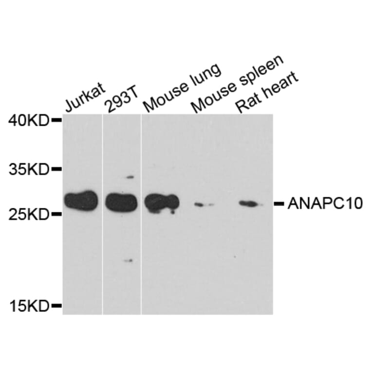 Western Blot - Anti-ANAPC10 Antibody (A8330) - Antibodies.com