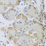 Immunohistochemistry - Anti-ANAPC10 Antibody (A8330) - Antibodies.com