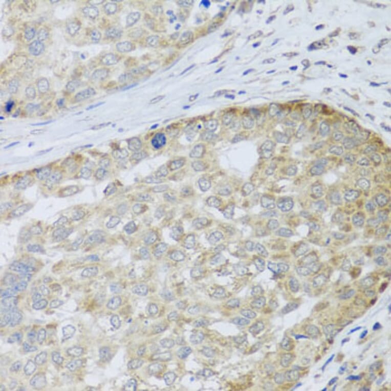 Immunohistochemistry - Anti-ANAPC10 Antibody (A8330) - Antibodies.com