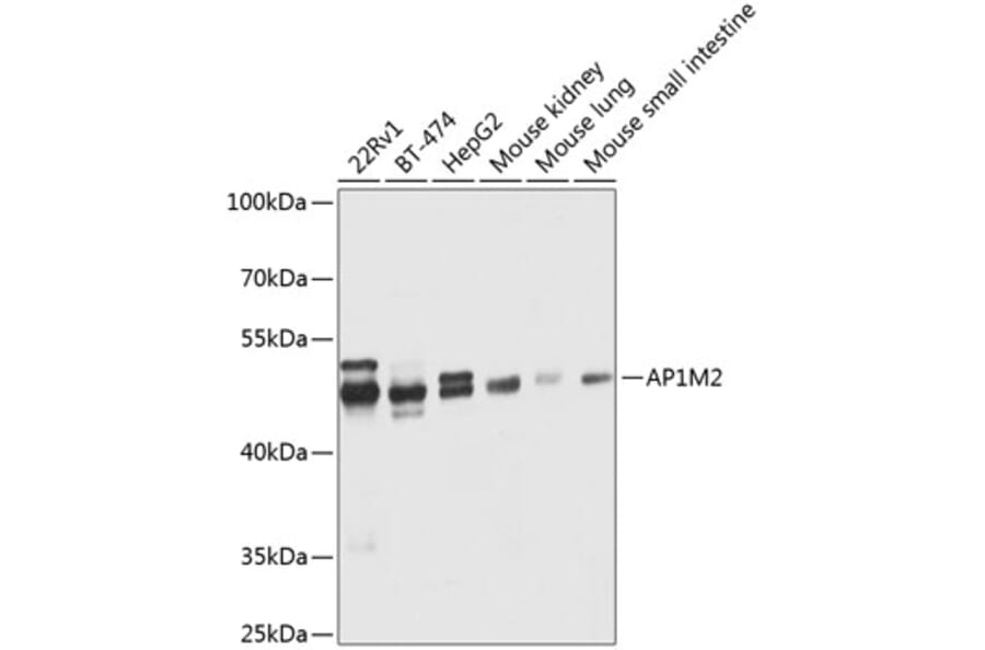 Western Blot - Anti-AP1M2 Antibody (A12237) - Antibodies.com