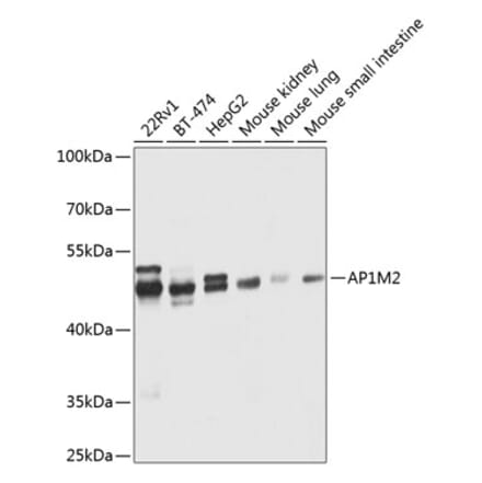 Western Blot - Anti-AP1M2 Antibody (A12237) - Antibodies.com