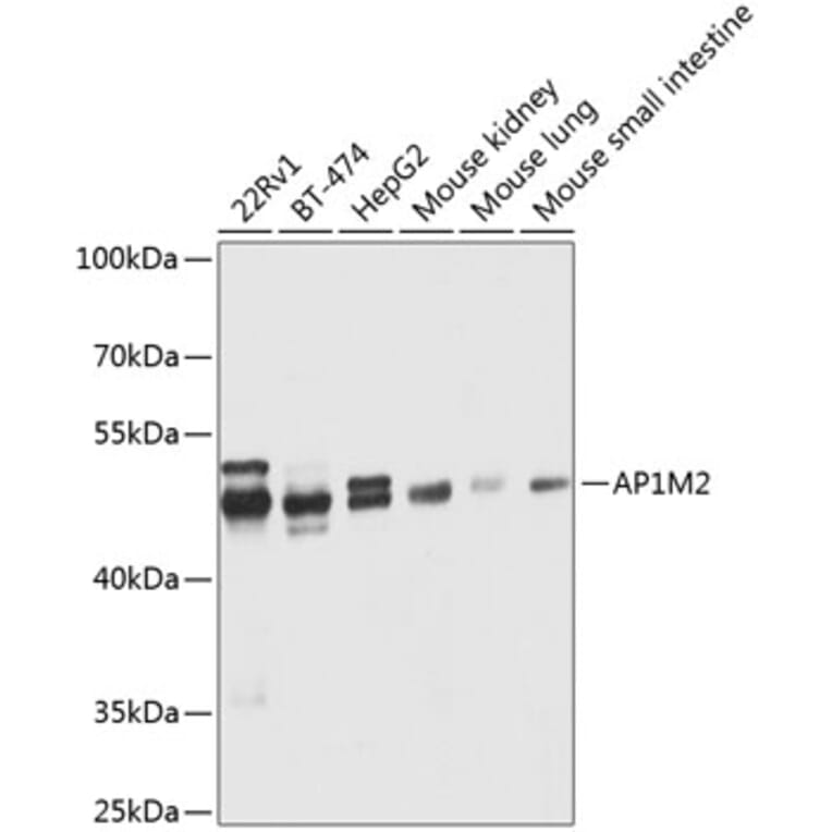 Western Blot - Anti-AP1M2 Antibody (A12237) - Antibodies.com