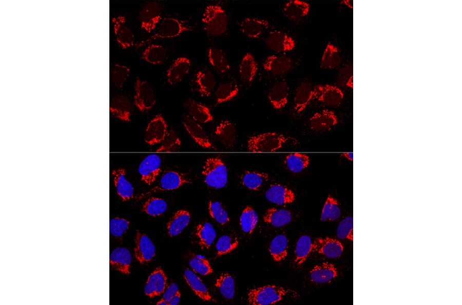 Immunofluorescence - Anti-AP1M2 Antibody (A12237) - Antibodies.com