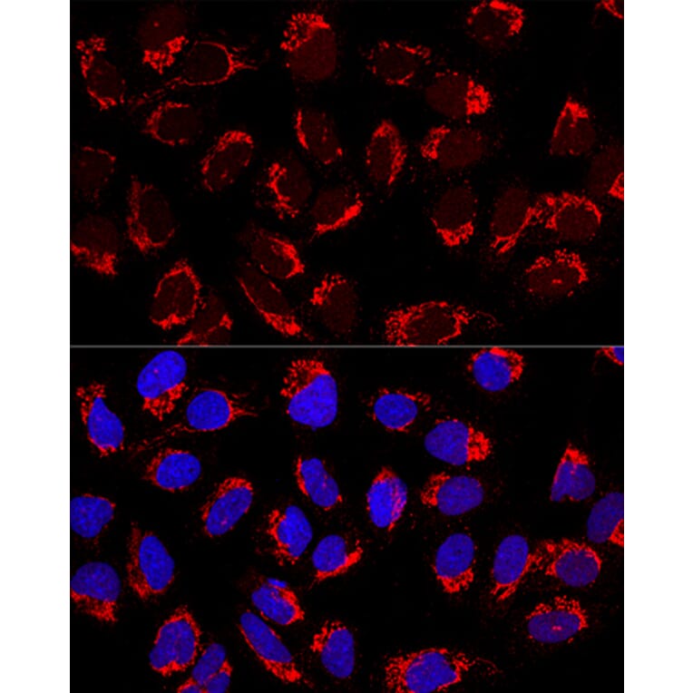 Immunofluorescence - Anti-AP1M2 Antibody (A12237) - Antibodies.com