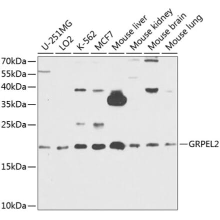 Western Blot - Anti-GRPEL2 Antibody (A12239) - Antibodies.com