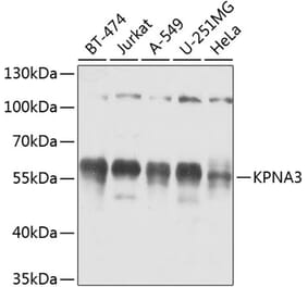 Western Blot - Anti-KPNA3 Antibody (A12240) - Antibodies.com