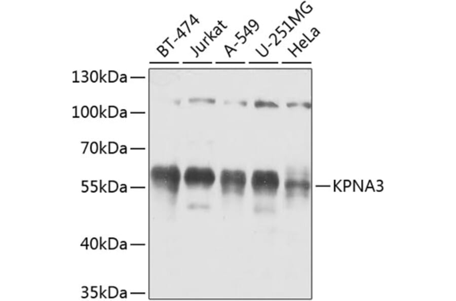 Western Blot - Anti-KPNA3 Antibody (A12240) - Antibodies.com