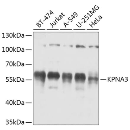 Western Blot - Anti-KPNA3 Antibody (A12240) - Antibodies.com
