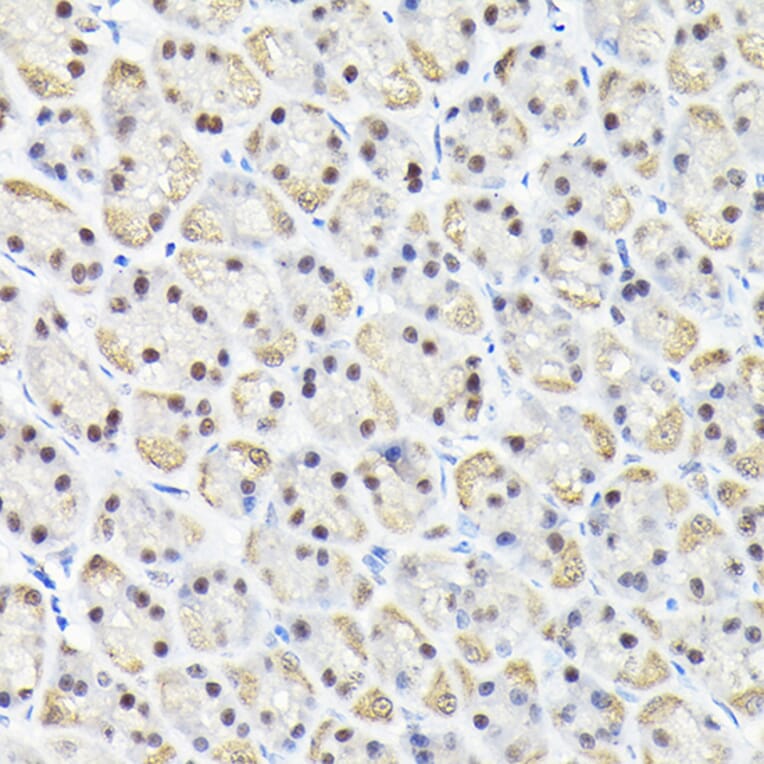 Immunohistochemistry - Anti-KPNA3 Antibody (A12240) - Antibodies.com