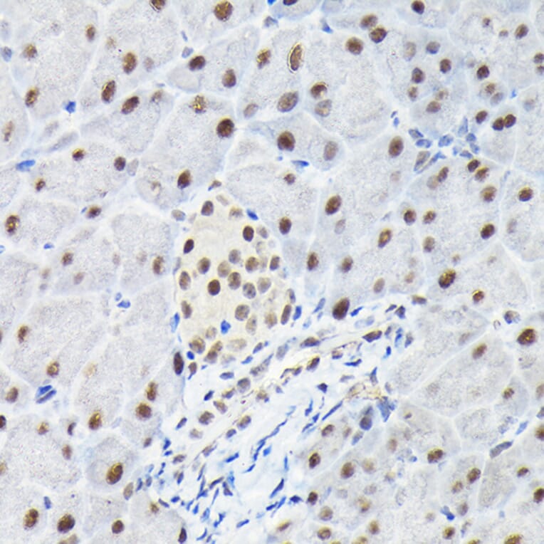 Immunohistochemistry - Anti-KPNA3 Antibody (A12240) - Antibodies.com