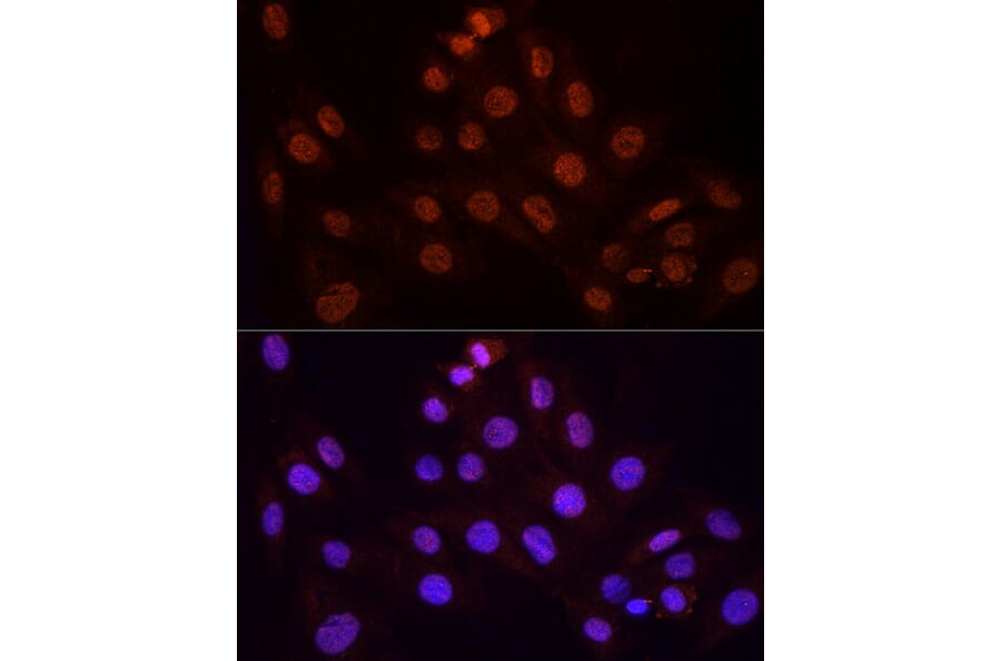 Immunofluorescence - Anti-KPNA3 Antibody (A12240) - Antibodies.com