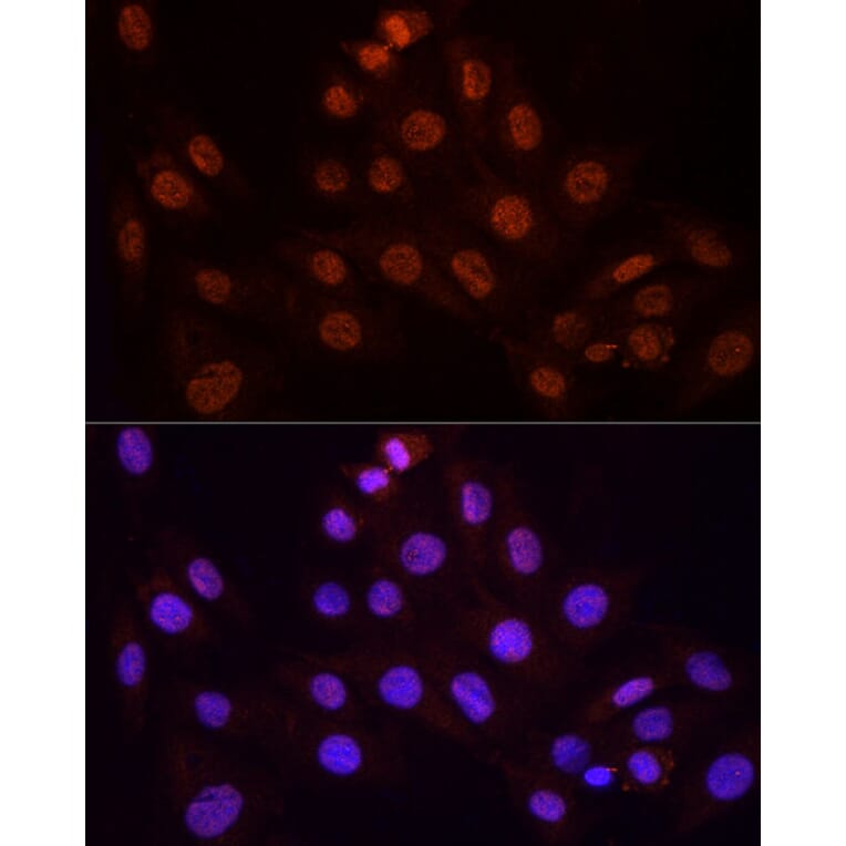 Immunofluorescence - Anti-KPNA3 Antibody (A12240) - Antibodies.com