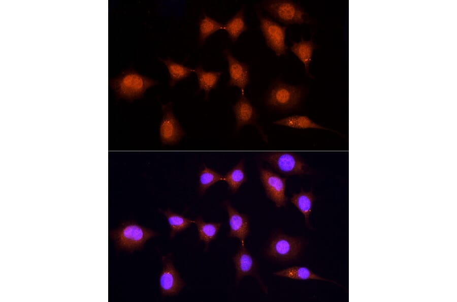 Immunofluorescence - Anti-KPNA3 Antibody (A12240) - Antibodies.com