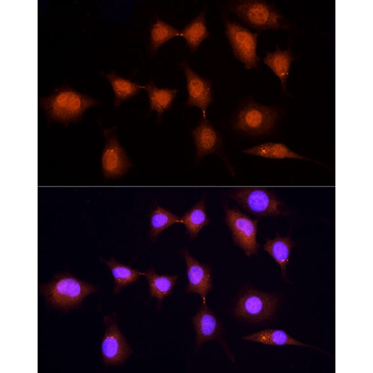 Immunofluorescence - Anti-KPNA3 Antibody (A12240) - Antibodies.com