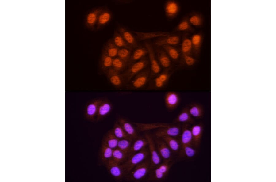 Immunofluorescence - Anti-KPNA3 Antibody (A12240) - Antibodies.com