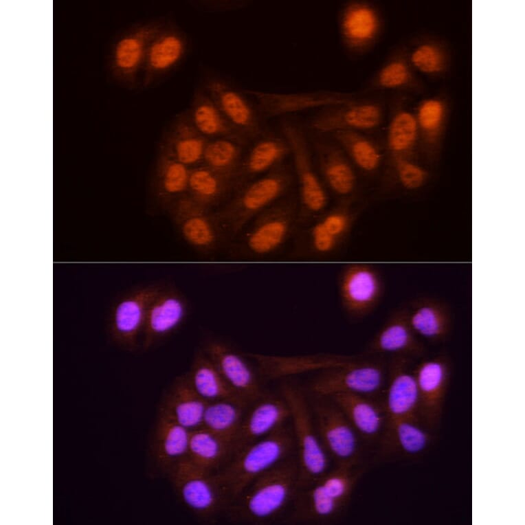 Immunofluorescence - Anti-KPNA3 Antibody (A12240) - Antibodies.com