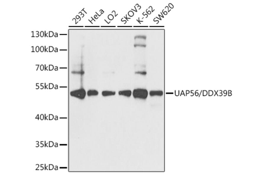 Western Blot - Anti-UAP56 Antibody (A12241) - Antibodies.com