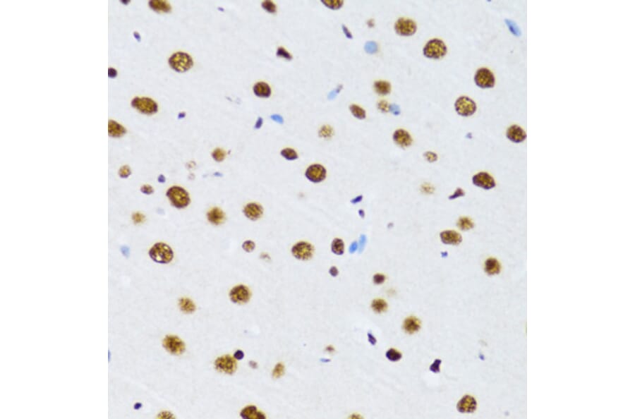 Immunohistochemistry - Anti-UAP56 Antibody (A12241) - Antibodies.com