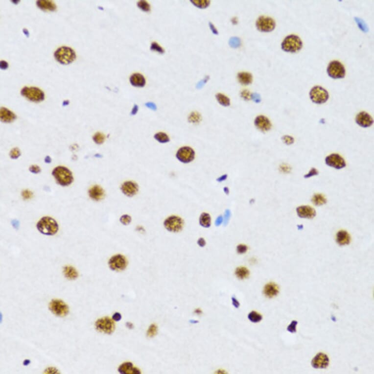 Immunohistochemistry - Anti-UAP56 Antibody (A12241) - Antibodies.com