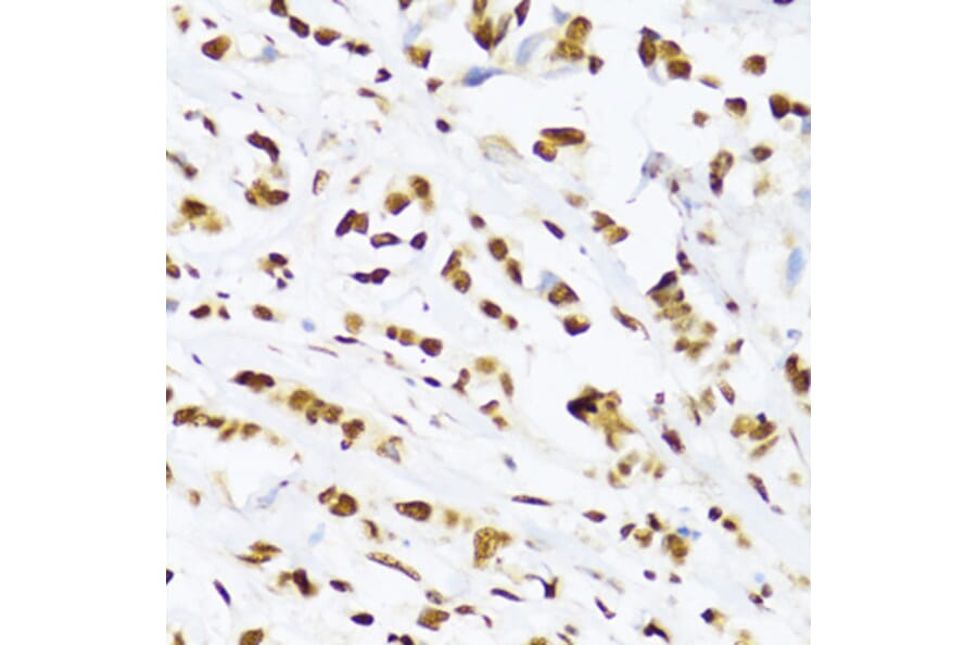 Immunohistochemistry - Anti-UAP56 Antibody (A12241) - Antibodies.com