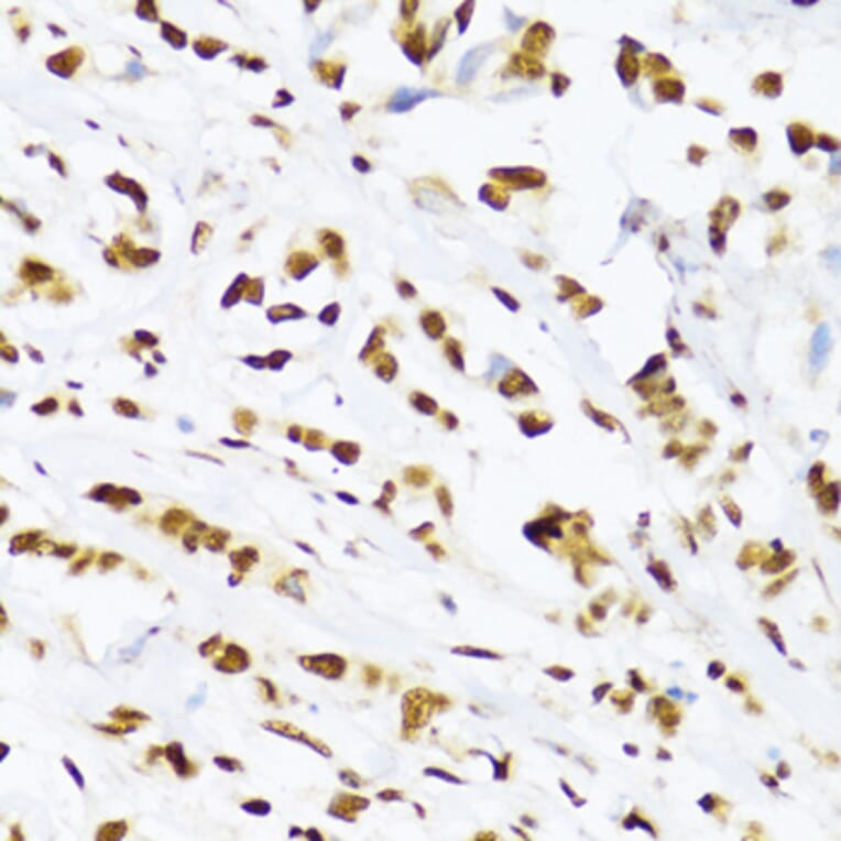Immunohistochemistry - Anti-UAP56 Antibody (A12241) - Antibodies.com