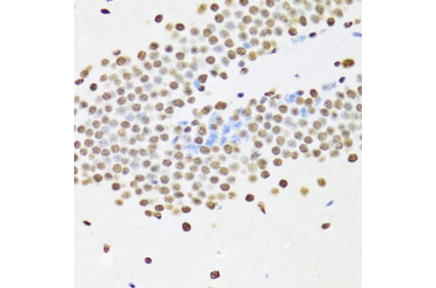 Immunohistochemistry - Anti-UAP56 Antibody (A12241) - Antibodies.com