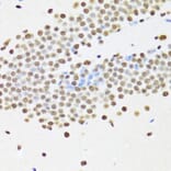 Immunohistochemistry - Anti-UAP56 Antibody (A12241) - Antibodies.com