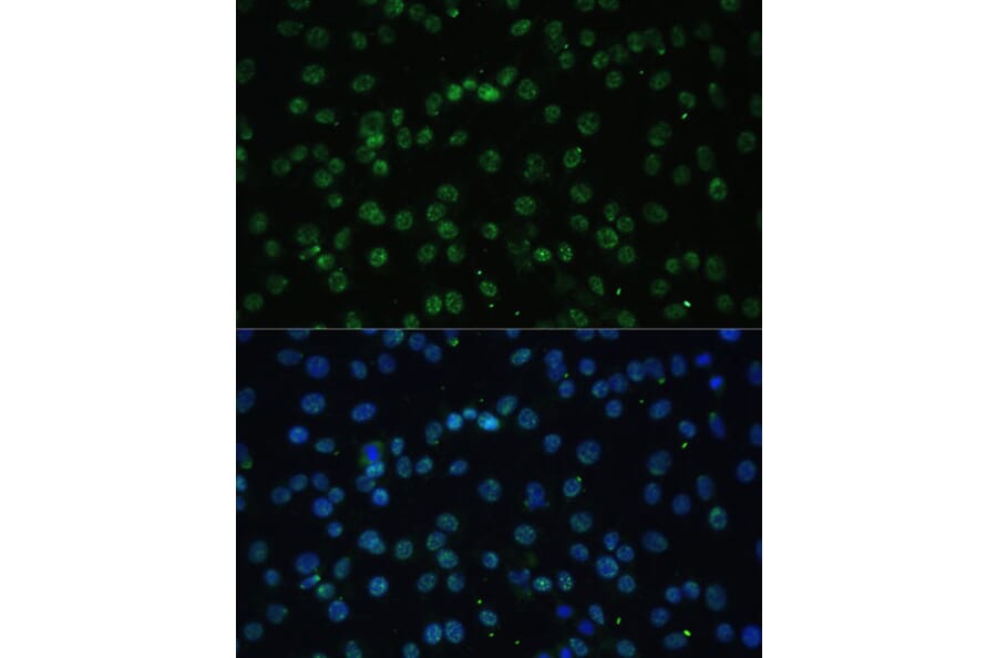 Immunofluorescence - Anti-UAP56 Antibody (A12241) - Antibodies.com