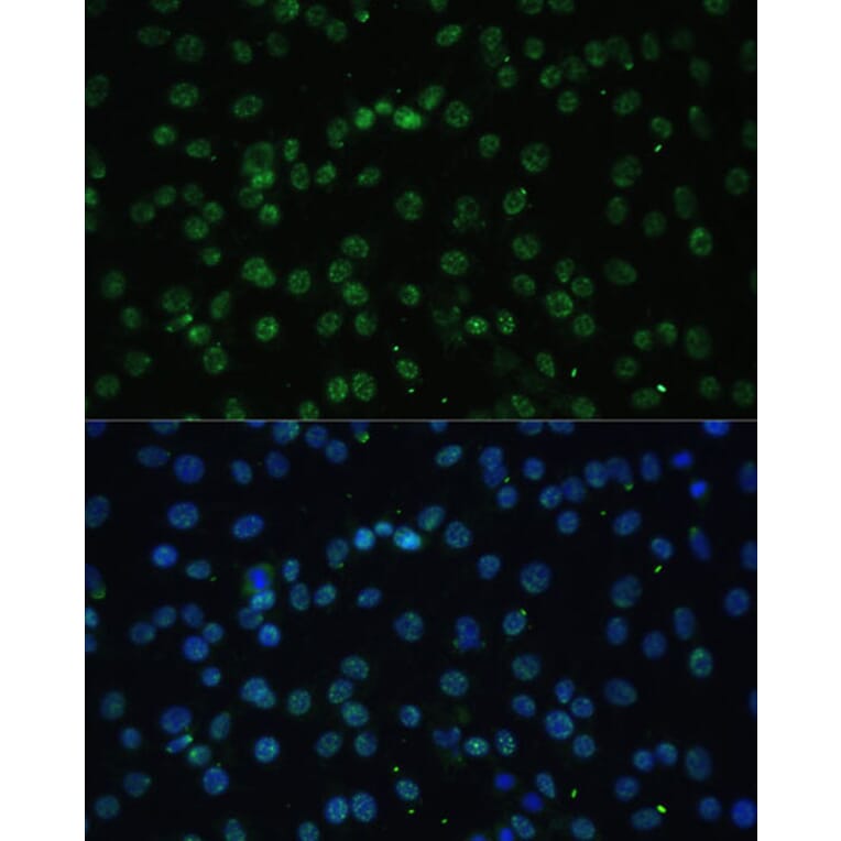 Immunofluorescence - Anti-UAP56 Antibody (A12241) - Antibodies.com