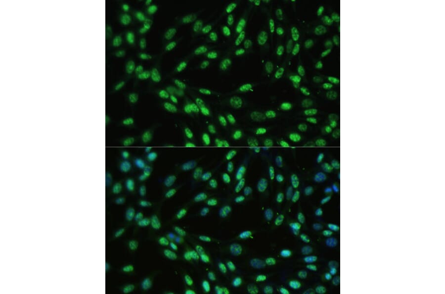 Immunofluorescence - Anti-UAP56 Antibody (A12241) - Antibodies.com