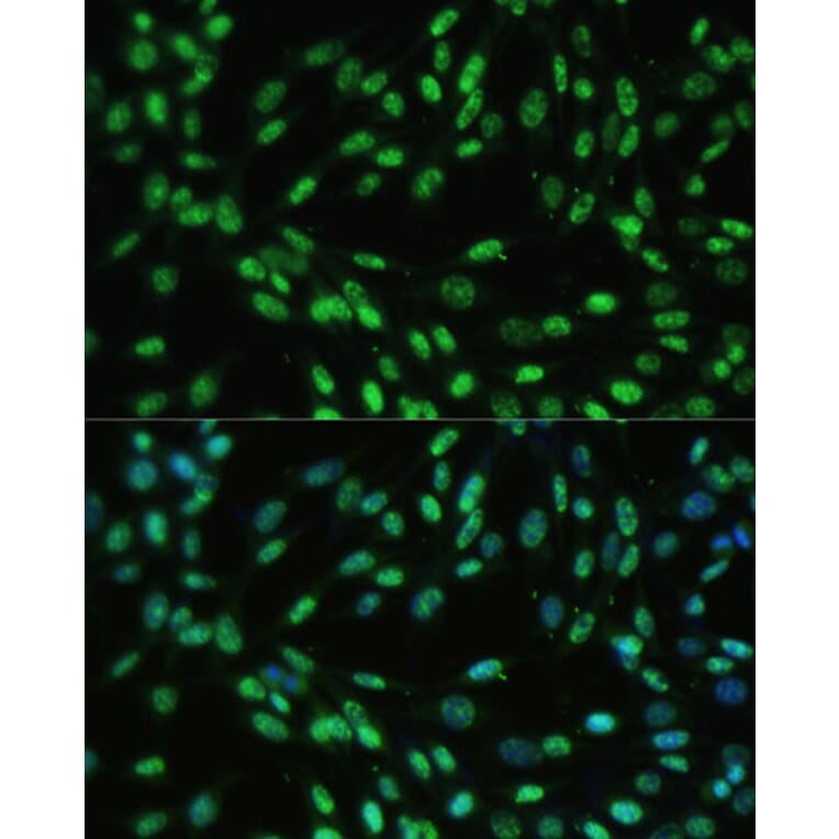 Immunofluorescence - Anti-UAP56 Antibody (A12241) - Antibodies.com